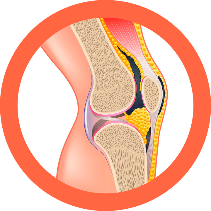 Hondroten restaure les articulations et les muscles.